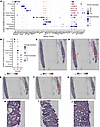 Urinary proteins associated with longitudinal eGFR decline are associated w