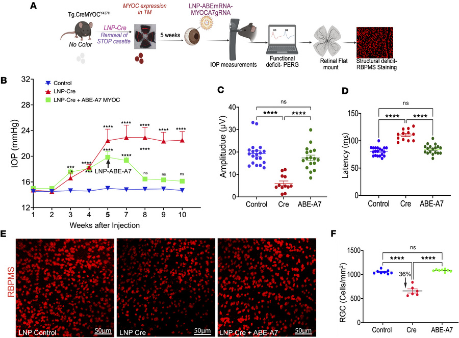 LNP-ABE-A7 rescues glaucoma in a mouse model of glaucoma.
(A) Schematic ...