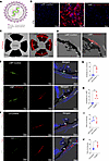 LNPs selectively and efficiently transduce the TM in vitro and in vivo, out
