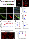 LNP-Cre mRNA induces glaucoma in a Cre-inducible MYOC glaucoma mouse model.