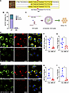 LNP-ABE edits MYOC and reduces intracellular accumulation of mutant MYOC in