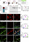 LNP-ABE-A7 edits MYOC and reduces intracellular mutant protein accumulation