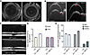 LNP-ABE-A7 shows no ocular toxicity or off-target editing effects in Tg.Cre