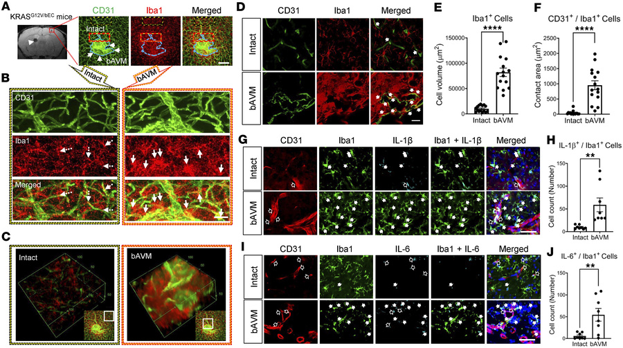 KRAS-ECs drive the activation of MG and infiltration of Mϕ toward bAVM t...