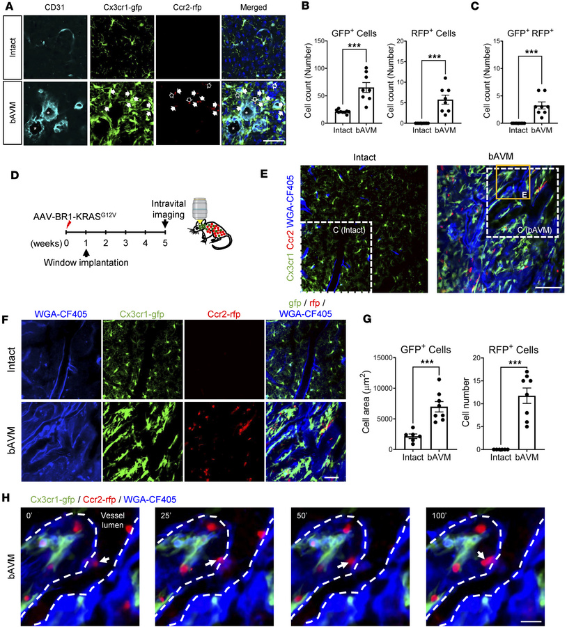 Intravital tracing of MG/Mϕ in bAVM territories in KRASG12V/bEC mice.
(A...
