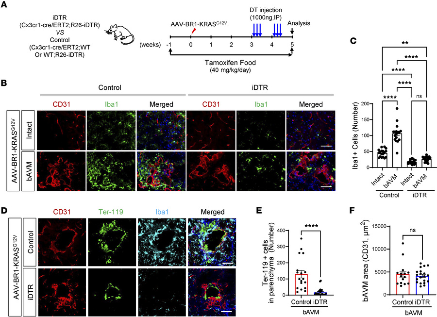 Genetic depletion of MG/Mϕ attenuates ICH in KRASG12V/bEC mice.
(A) iDTR...