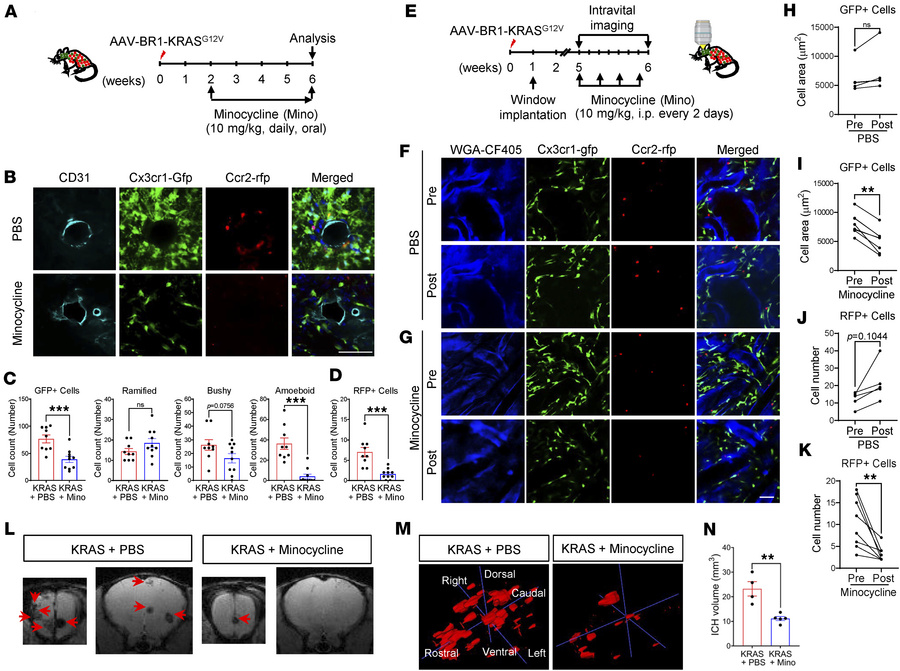 Minocycline reduces activation of MG and recruitment of Mϕ toward bAVM t...