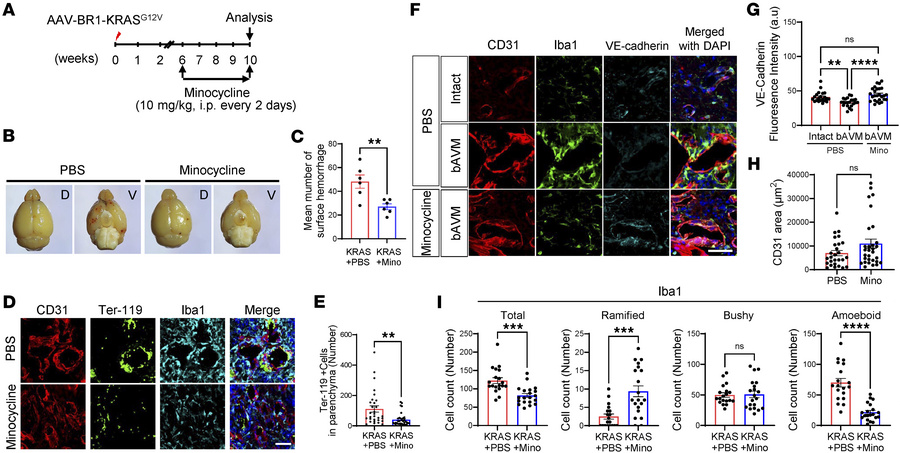 Posttreatment with minocycline attenuates ICH in KRASG12V/bEC mice.
(A) ...
