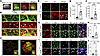 KRAS-ECs drive the activation of MG and infiltration of Mϕ toward bAVM terr