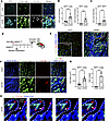 Intravital tracing of MG/Mϕ in bAVM territories in KRASG12V/bEC mice.
