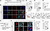 Early-stage–activated MG are responsible for the ICH occurrence in KRASG12V
