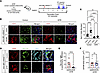Genetic depletion of MG/Mϕ attenuates ICH in KRASG12V/bEC mice.