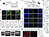Minocycline reduces activation of MG and recruitment of Mϕ toward bAVM terr