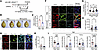 Posttreatment with minocycline attenuates ICH in KRASG12V/bEC mice.
