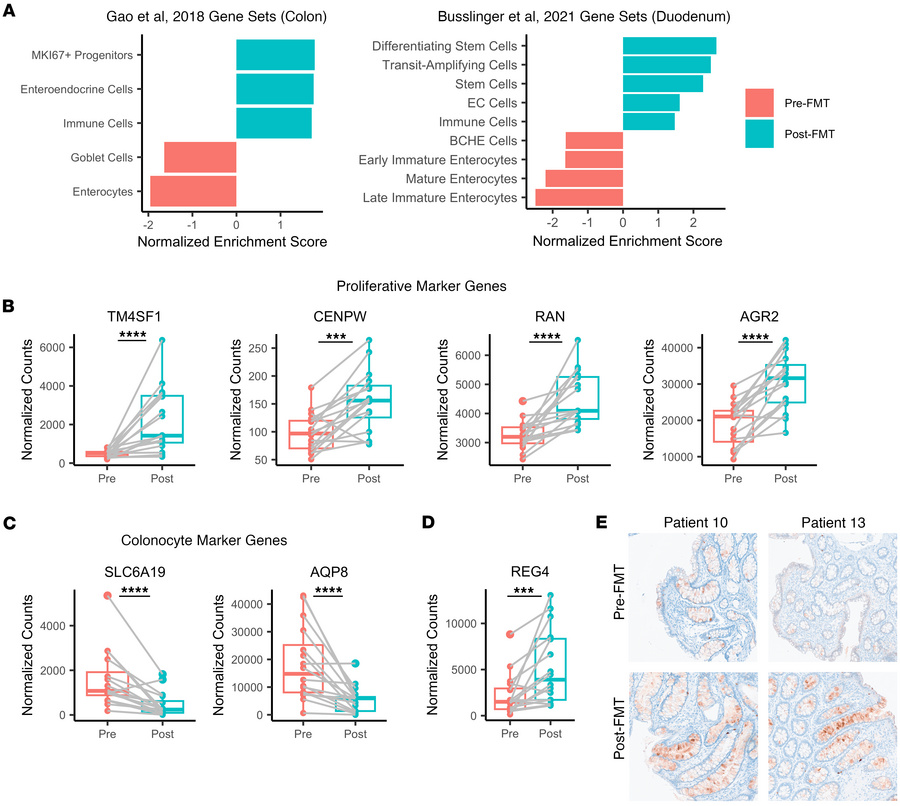 FMT promotes enrichment of proliferative crypt cell types.
(A) GSEA rank...