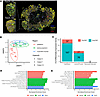 Colonic transcriptional changes are driven by changes in the epithelium.