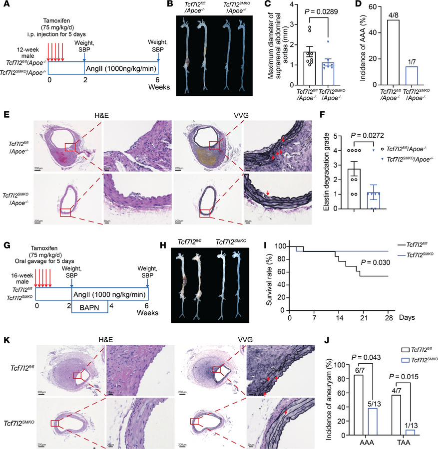 VSMC-TCF7L2 deficiency attenuates Ang II and BAPN/Ang II–induced AAA in ...