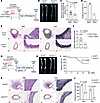 VSMC-TCF7L2 deficiency attenuates Ang II and BAPN/Ang II–induced AAA in mic