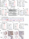 TCF7L2 upregulates MMP14 expression in VSMCs and AAA lesions.
