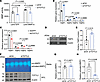 TCF7L2 promotes MMP activity by upregulating MMP14 and repressing TIMP3.