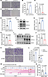 TCF7L2 represses ITGB1 to disrupt VSMC-ECM adhesion.
