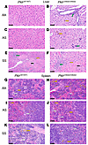 Coinheritance of Pklr-null mutations [Pklr(13ntdel/13ntdel) or Pklr(246ntde