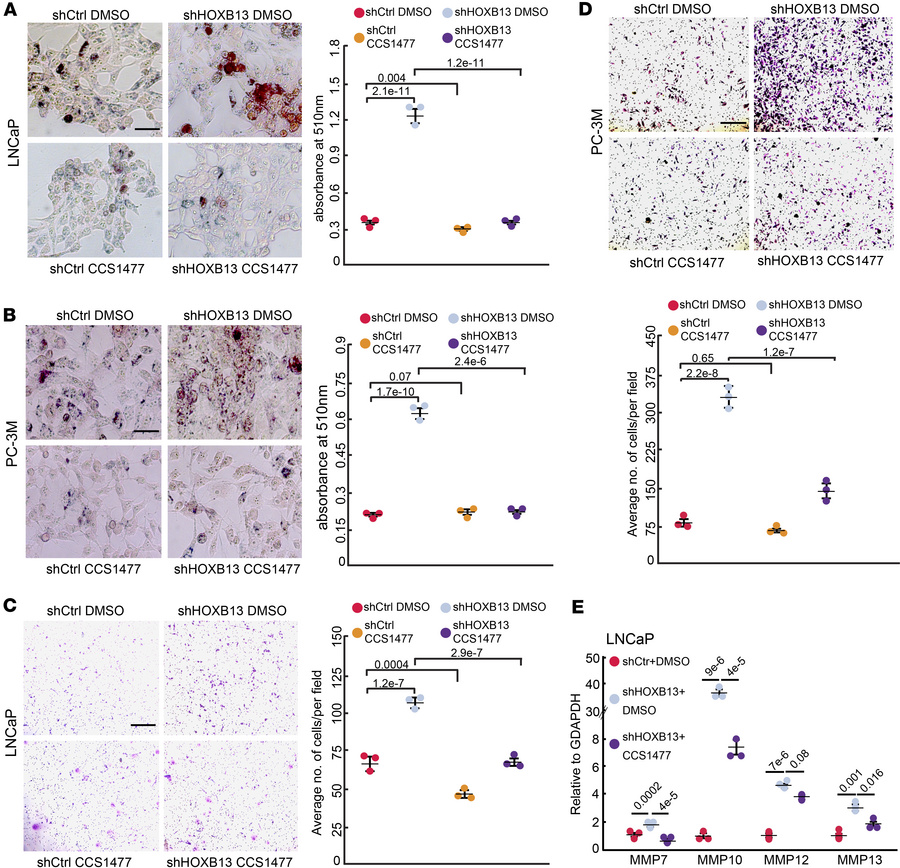 p300 and CBP inhibitors mitigate HOXB13-KD-induced lipid accumulation an...