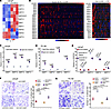 Lipid-induced MMP genes mediate HOXB13-loss-induced cell motility.