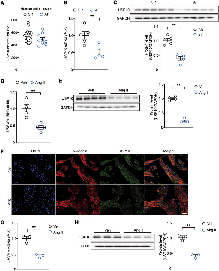 USP10 is decreased in patients with AF and Ang II–treated atrial cardiom...