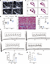 USP10 overexpression ameliorates Ang II–induced atrial remodeling and AF su