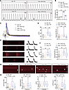 USP10 overexpression mitigates abnormal calcium handling and DADs.