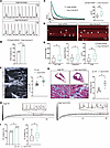 USP10 knockdown exacerbates abnormal calcium handling, DADs, and AF suscept