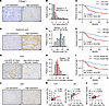 Correlation between CAF and ECM components, CD31 microvascular density, and