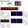 In vivo enhanced drug delivery of panitumumab and Abraxane by FAP-targeted