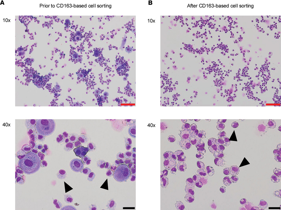 Enrichment of HBCs by CD163-based cell sorting.
Cytospin microscopic pic...