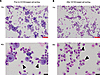 Enrichment of HBCs by CD163-based cell sorting.