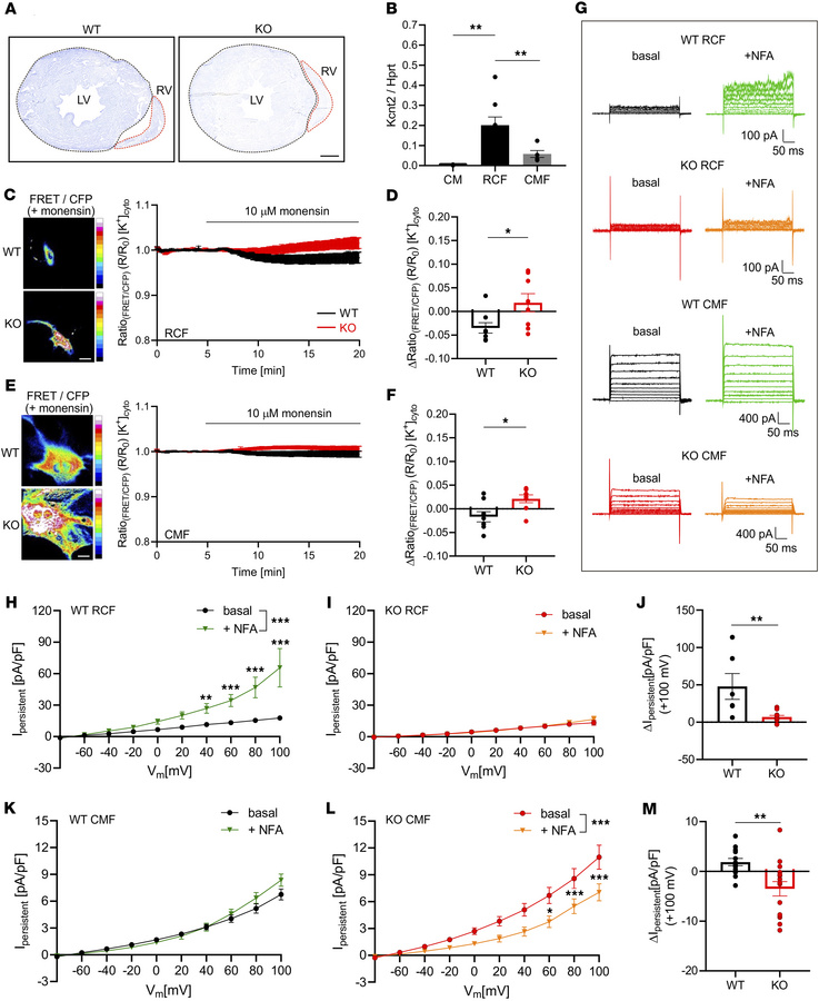 Expression and functional characterization of Slick in RCFs and CMFs.
(A...