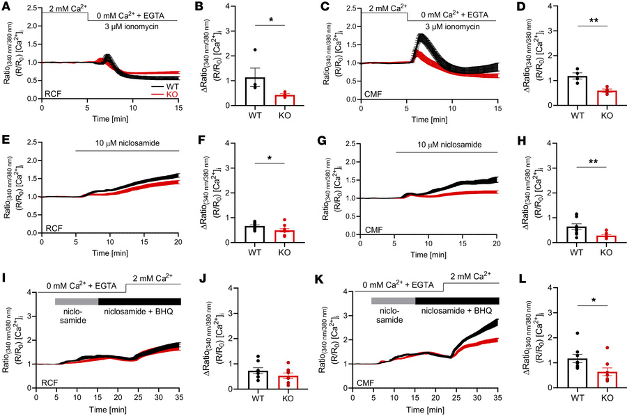 Loss of Slick in RCFs and CMFs disrupts [Ca2+]i dynamics.
(A) Normalized...