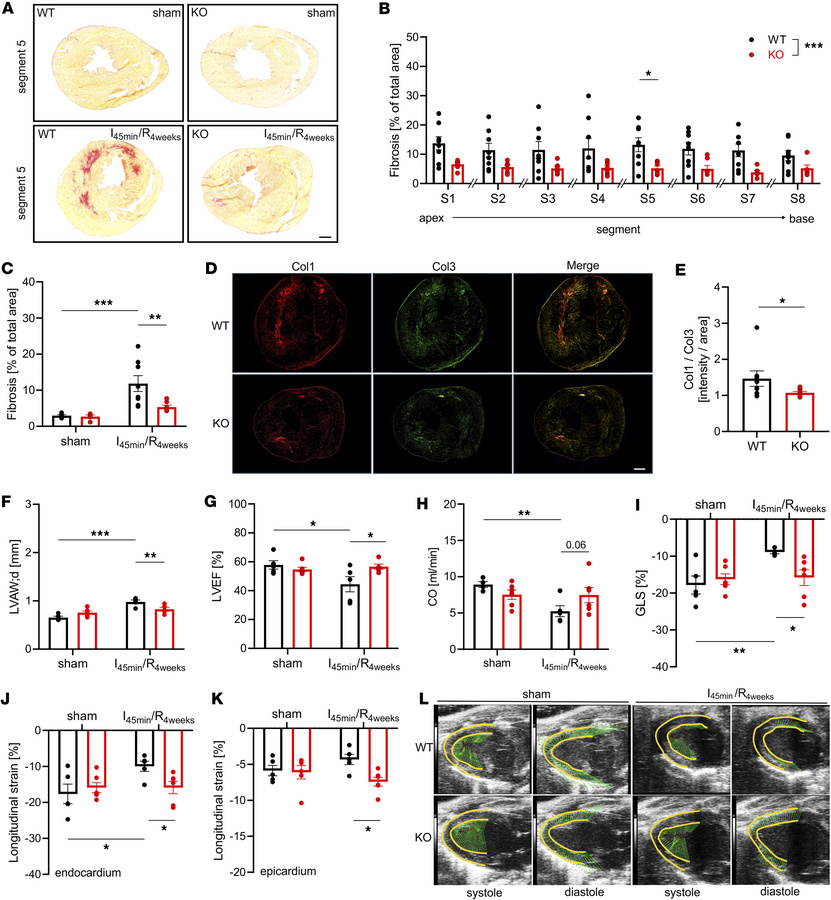 Global Slick deletion attenuates fibrogenesis and preserves LV function ...