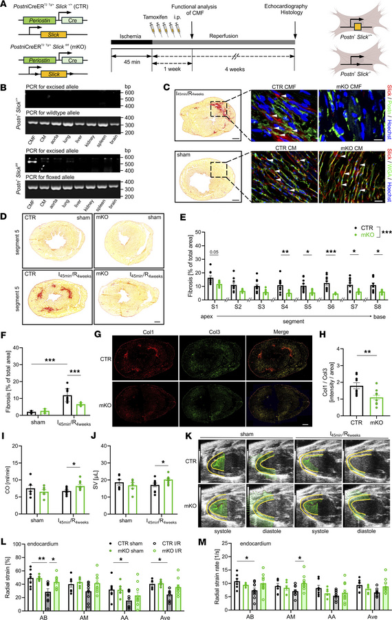 Cell-specific ablation of CMF Slick channels attenuates fibrogenesis and...