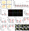 Global Slick deletion attenuates fibrogenesis and preserves LV function aft