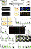 Cell-specific ablation of CMF Slick channels attenuates fibrogenesis and LV