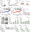Loss of Slick attenuates proliferation and fibrotic gene expression in CMFI
