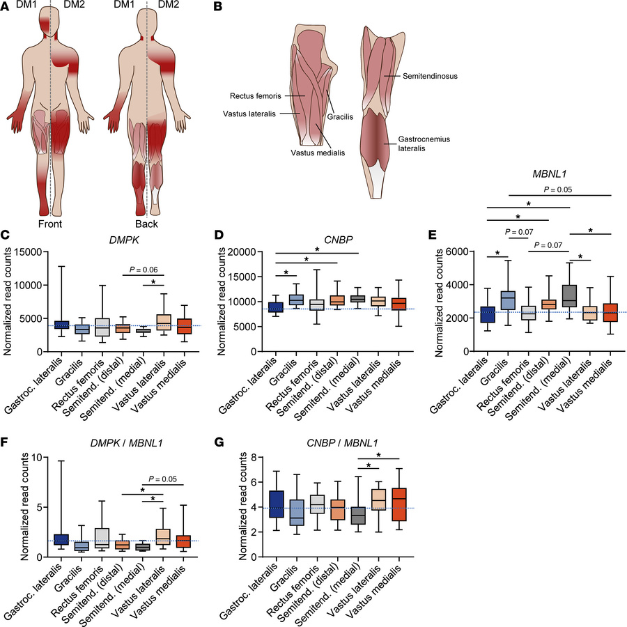 Differential disease relevant gene expression across healthy human muscl...