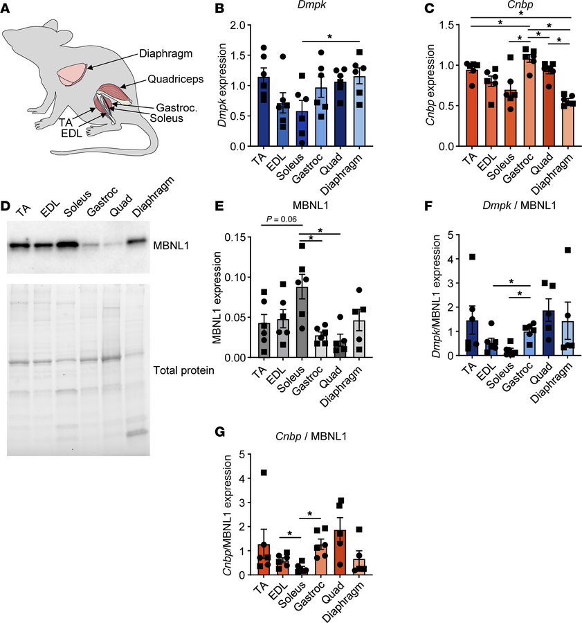 JCI Insight - Differential pathology and susceptibility to MBNL loss ...