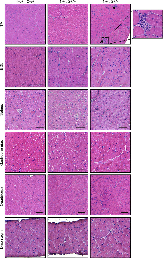 The TA muscle recapitulates more DM-like histopathology than other muscl...