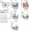 Differential disease relevant gene expression across WT mouse muscles.