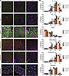 Fiber type switching is greater in predominantly fast-twitch glycolytic mus