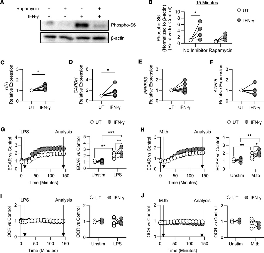 IFN-γ training metabolically reprograms human macrophages.
(A and B) Sor...