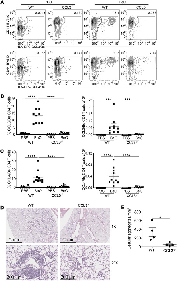 HLA-DP2 tetramer staining of CD4+ T cells in BeO/LPS-exposed WT and CCL3...
